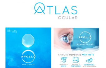 Bahram Alavi Unveils Revolutionary Apollo Amniotic Membrane Graft Technology at Atlas Ocular Atlas Ocular’s Bahram Alavi announces the launch of the revolutionary Apollo Amniotic Membrane Graft Technology, designed to enhance ocular healing through its anti-scarring, anti-inflammatory, and healing-promoting properties.